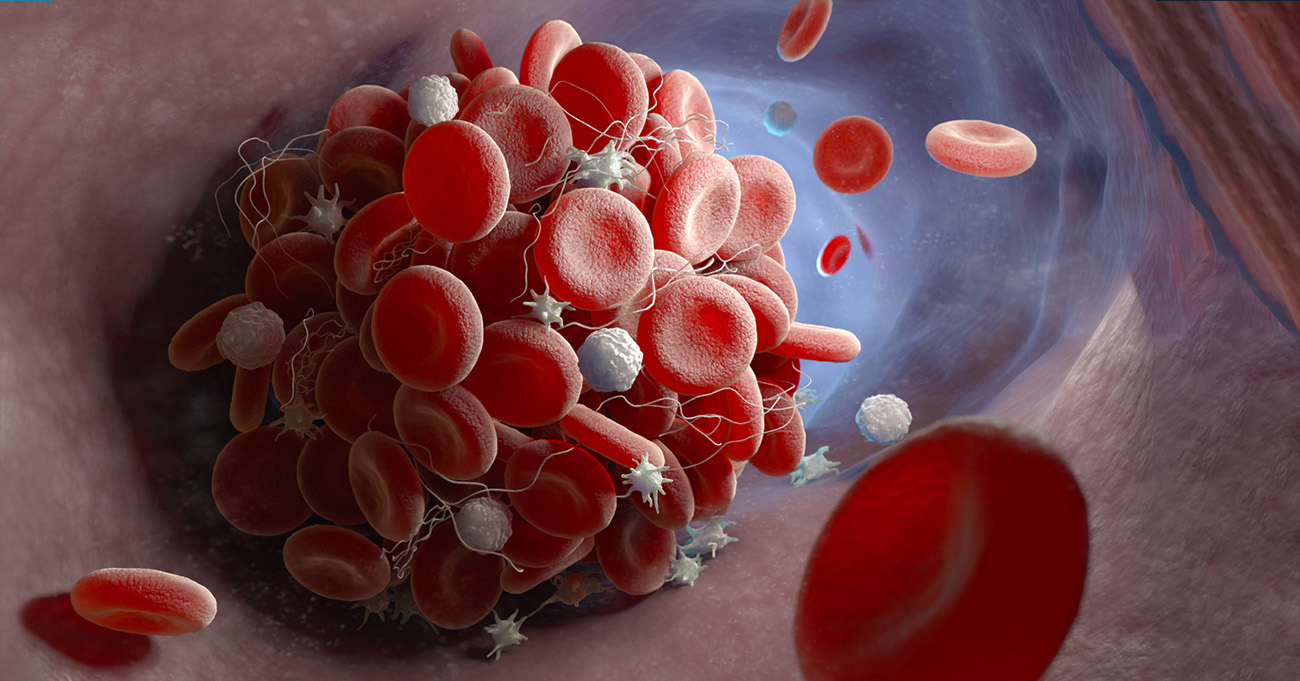 Aurora St. Luke’s Medical Center study evaluates chilled platelets during transfusion